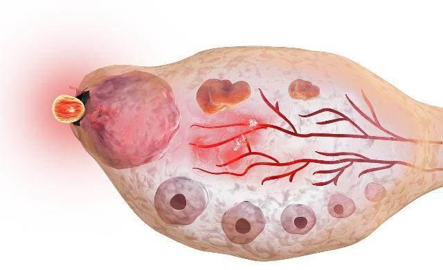 排卵期的女人五种表现,女性出现这6种变化说明你怀孕了
