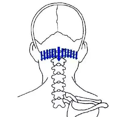 刮痧治疗感冒的操作流程,风寒感冒刮痧哪里效果最好图解