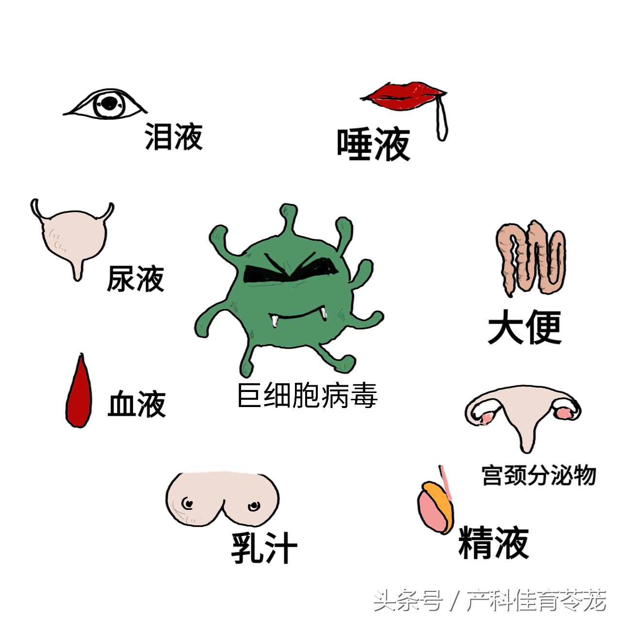 妊娠合并巨细胞病毒感染,孕期感染了巨细胞病毒有什么症状