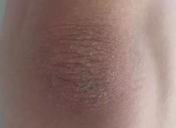 洗屁屁变白的香皂,洗屁屁香皂真的会变白吗