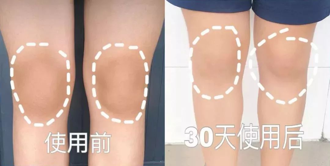 洗屁屁变白的香皂,洗屁屁香皂真的会变白吗