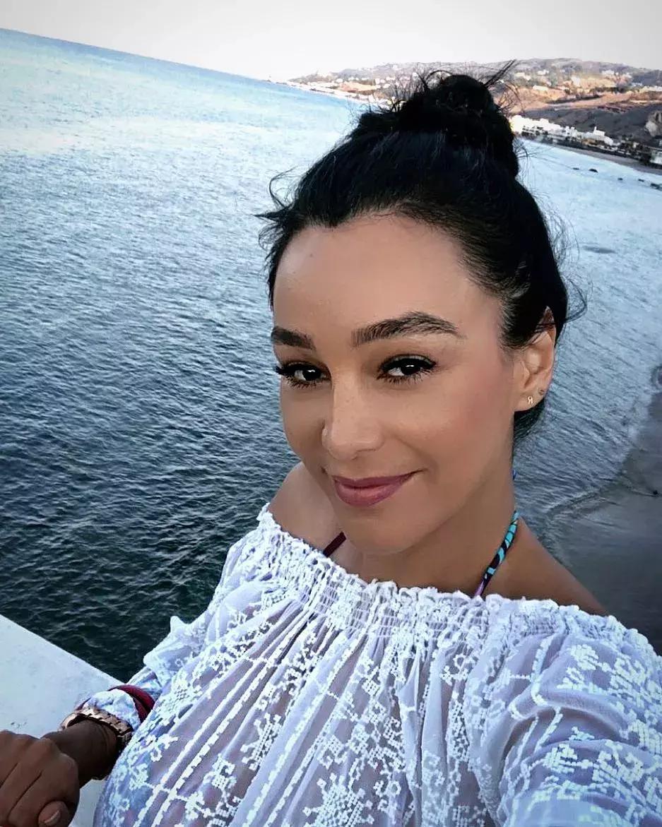 祛痘除了刷酸还有别的办法吗,祛痘立马见效办法