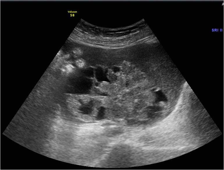 4种癌症影响女人一生健康!