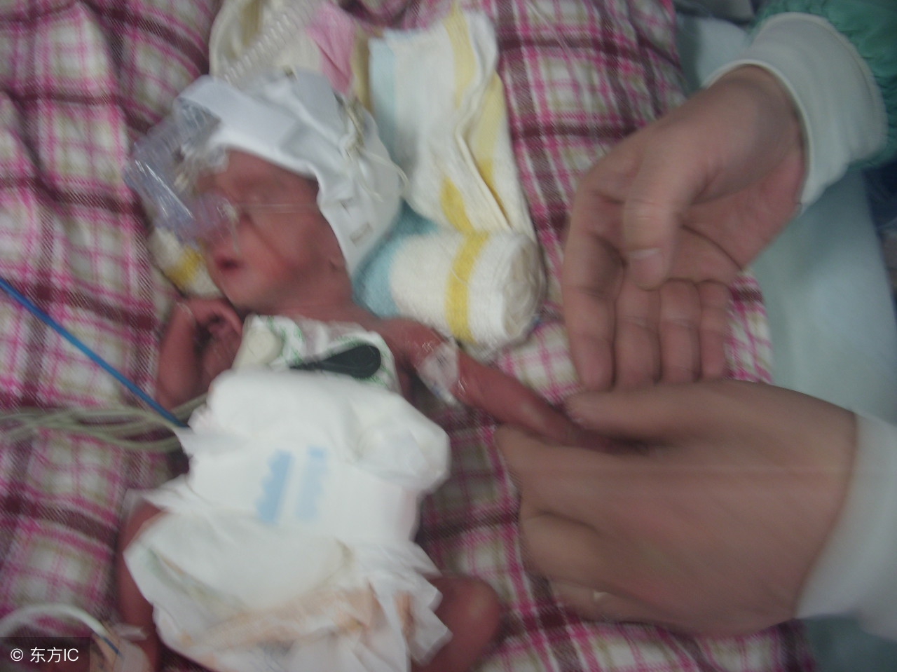 早产儿注意事项和护理方法,早产儿的护理与喂养小视频