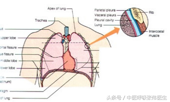 肺癌恶性胸腔积液能活多久,恶性胸腔积液引流几天取管