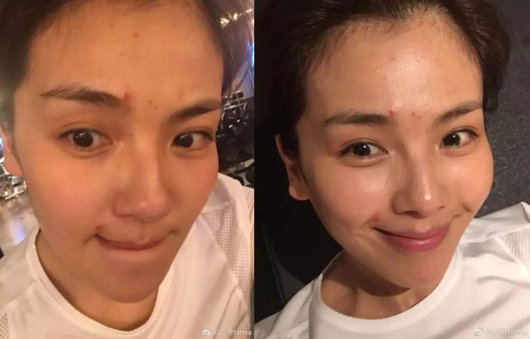 假期晒黑了怎么快速变白？试试刘雯、张馨予、林允的皮肤急救方案