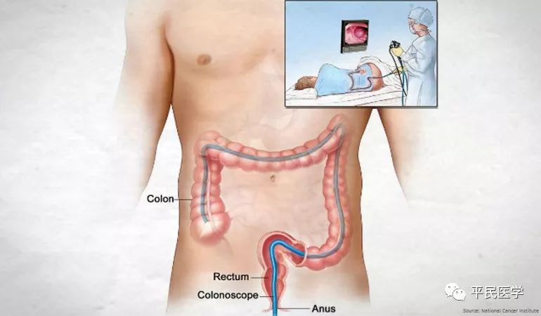 便血查出来肠癌的多吗,便血查出肠癌怎么办