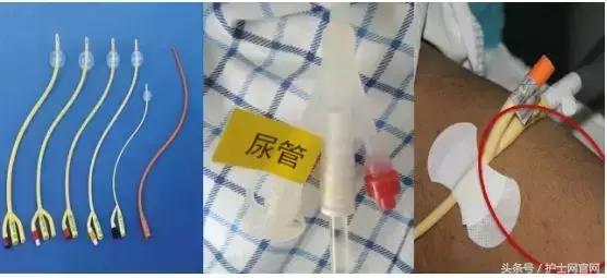 两条生命线一粗一细,两条生命线一细一粗