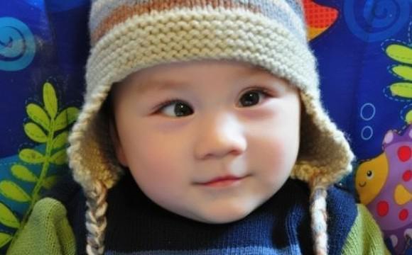 斗鸡眼如何预防和治疗,预防宝宝斜视斗鸡眼