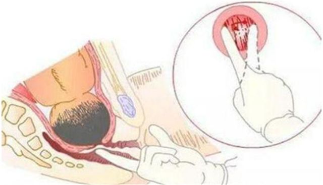分娩在即准妈妈请牢记这些知识点,孕妈刚分娩完说什么