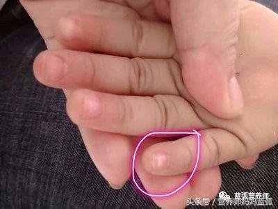 宝宝指甲白斑、凹陷、扁平、分层、脱皮别不在意，有的提示重病！