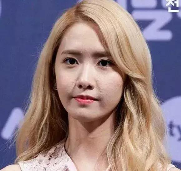 战痘的四个小方法,战痘女孩的秘笈