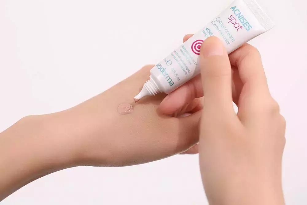 战痘的四个小方法,战痘女孩的秘笈