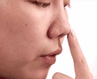 战痘的四个小方法,战痘女孩的秘笈