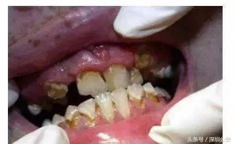 禁毒减肥法图片大全,禁毒减肥法图片