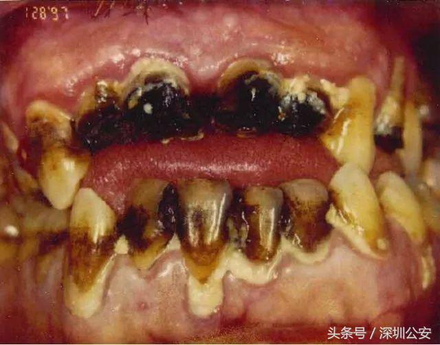 禁毒减肥法图片大全,禁毒减肥法图片