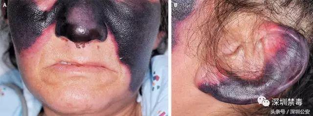 禁毒减肥法图片大全,禁毒减肥法图片