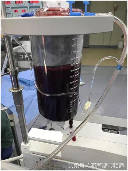 杭州26岁姑娘腹痛,女子腹痛便血医生称没事