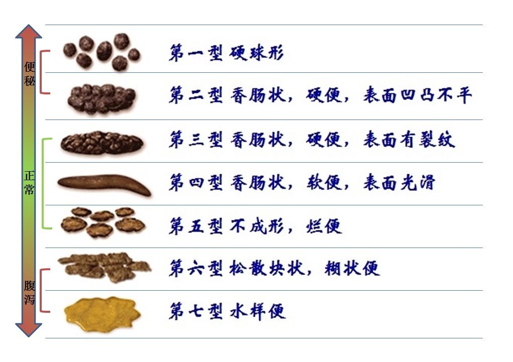 婴幼儿正常大便的颜色和性状,婴幼儿大便怎么护理