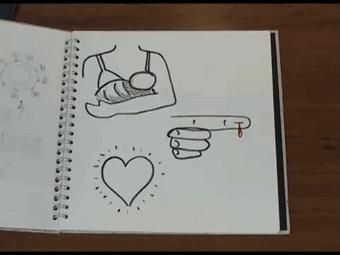 蚊虫叮咬会有传染艾滋病的危险吗,蚊虫叮咬会不会导致艾滋病传染