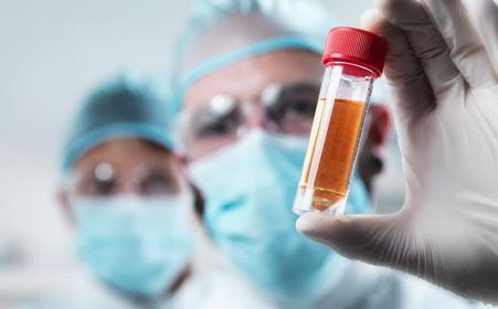 孕妇怎么预防新生儿溶血症,怀孕溶血孕前怎么治疗