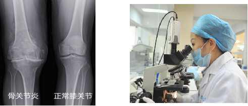 换季关节疼痛解决最好办法,冬季关节疼痛如何防治