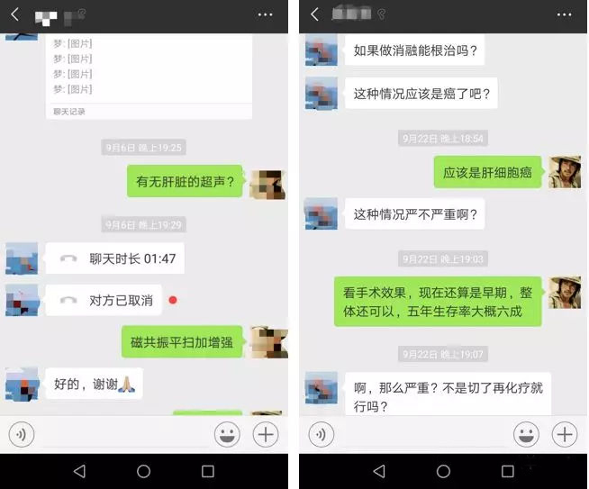 早期肝癌肿瘤怎么治疗效果好,肝癌car-t疗法据说5年生存率有90%