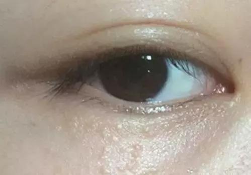 红霉素软膏一块钱和七块钱的区别,红霉素软膏跟眼膏效果一样吗