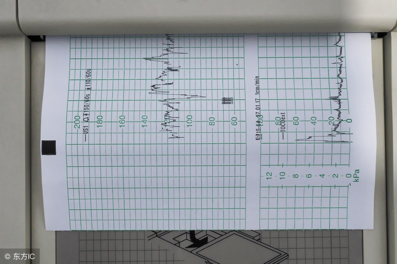 胎心监护不过关怎么样可以胎动,胎心监护发现问题怎么改善
