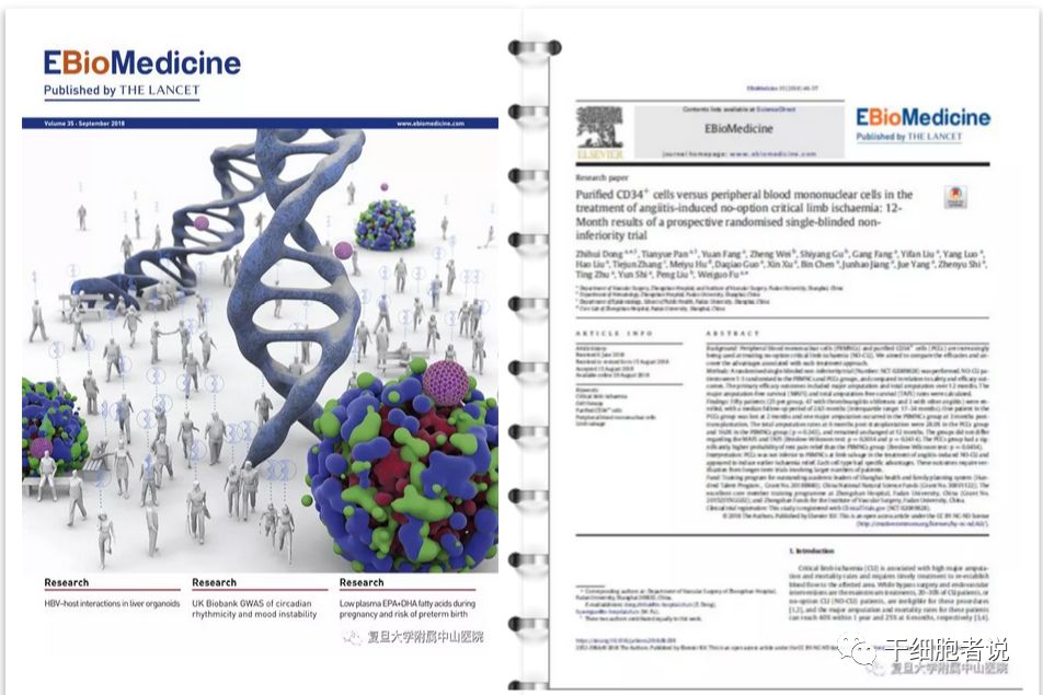 干细胞技术竟然可以“生死肉骨”？！中山医院自体干细胞移植治疗难治性重度肢体缺血