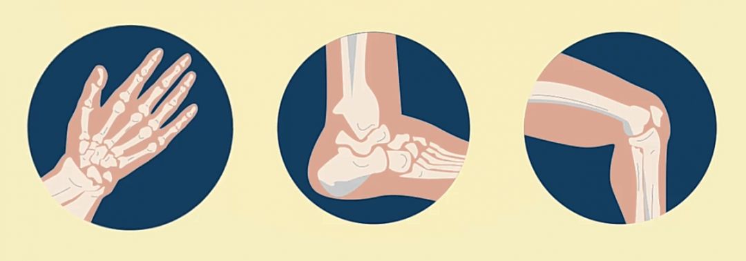 缺钙怎么确定,缺钙了个子会矮小吗