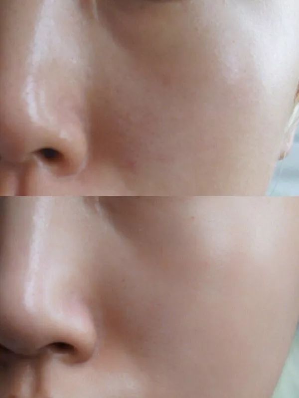 面膜女士补水美白神器第一名,美白神器400元