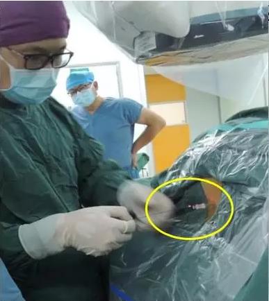 腰椎间盘突出激光汽化手术缺点,腰椎间盘突出的骨刺能用激光吗