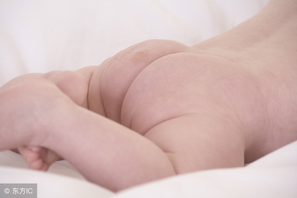 宝宝红屁股该怎么护理,宝宝反复红屁股应该怎样应对呢