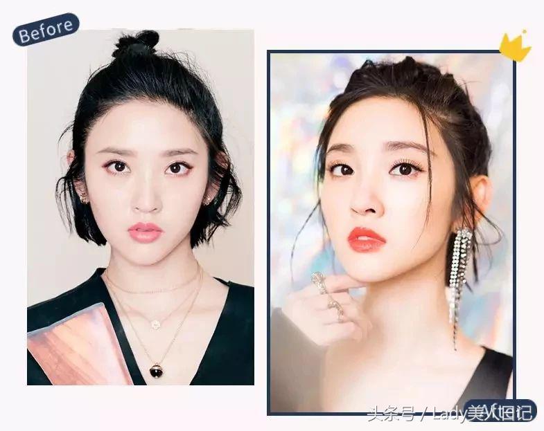 高级脸整容成功削骨,大脸削骨整容前后对比