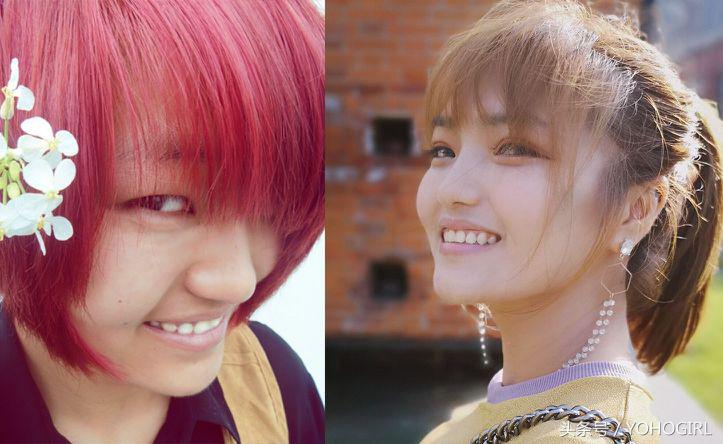 把痣点了后悔怎么办,为什么很多人点痣后悔