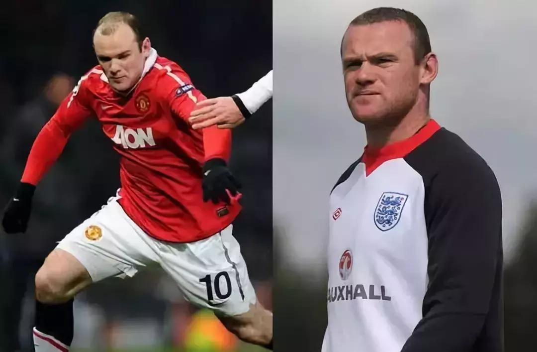 有许多明星脱发是怎样补救的,明星脱发都用什么方法