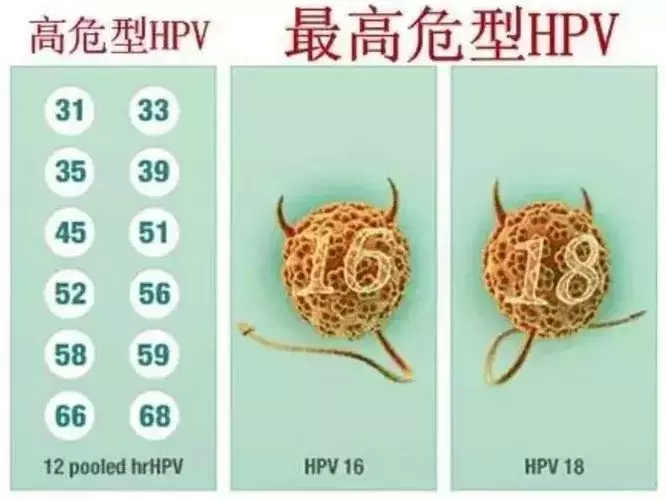 HPV检测，都有哪些你不知道的坑？