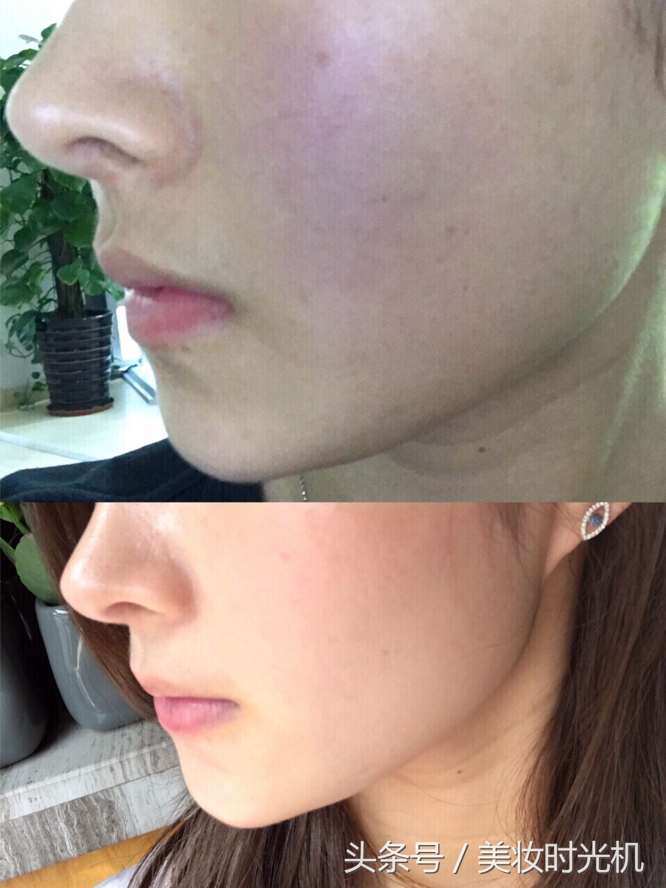 20款面膜使用感合集,医美修复面膜siaekey好用吗