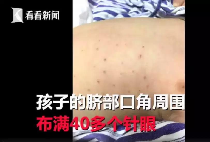 婴儿体内被扎针是意外还是人为,孩子被针管扎后家长怎么处理