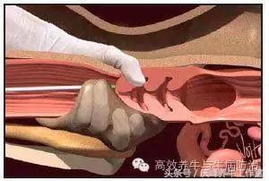 给牛人工授精完成后续注意事项,给牛人工授精需要注意什么