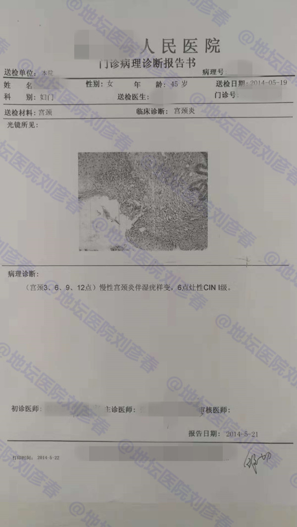 接触性出血是癌症的前兆吗,接触性出血是肿瘤晚期吗