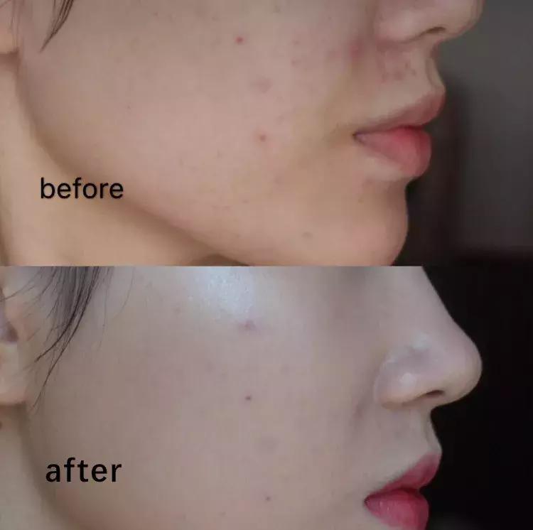 适合混油皮的秋冬季粉底液,适合干皮妹子的粉底