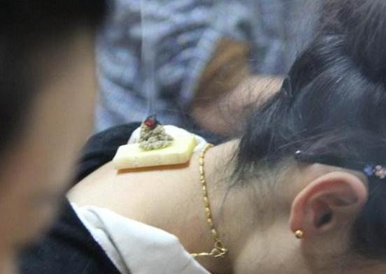 艾灸的排病真的不能避免？其实这是身体调整是一个先修后复的过程