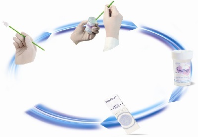 做什么检查能查出宫颈癌,一般做什么检查筛查宫颈癌