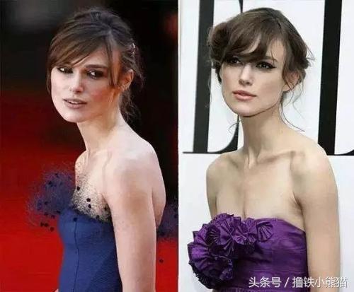 直背训练纠正驼背,你的背弯了怎么纠正