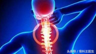 甲钴胺能治疗腰间盘突出吗,颈椎间盘突出压迫硬膜囊吃甲钴胺