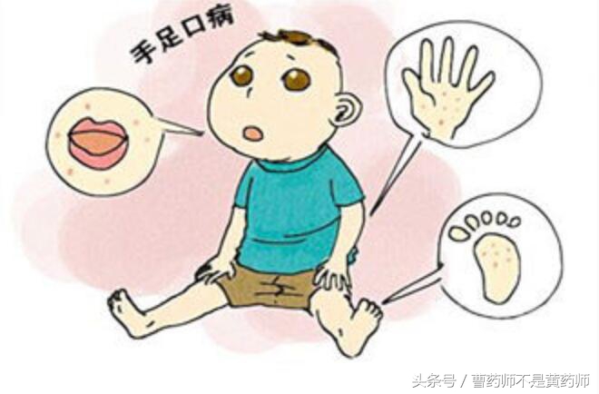 幼儿手足口病的最佳治疗方法,幼儿手足口病的预防和护理方法