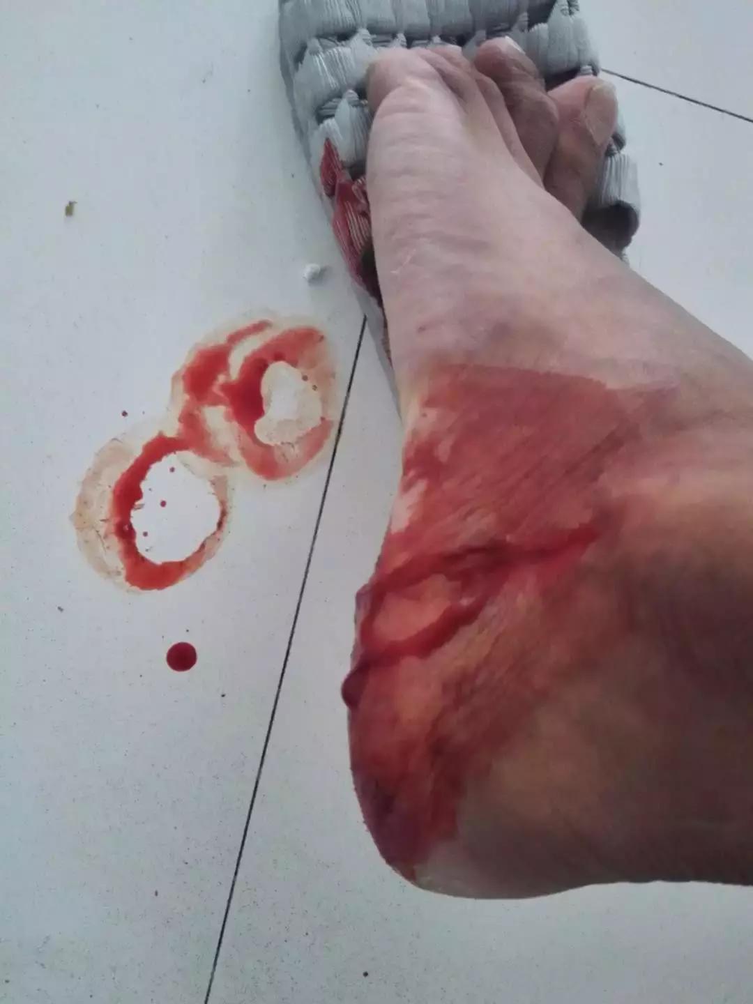 在山里遇到野猪怎么保护自己,在野外遇到野猪该怎么保命