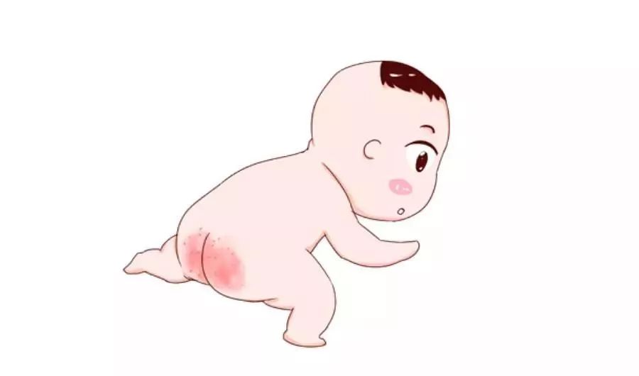 宝宝腹泻红屁股怎么办,宝宝红屁股擦什么药好得快